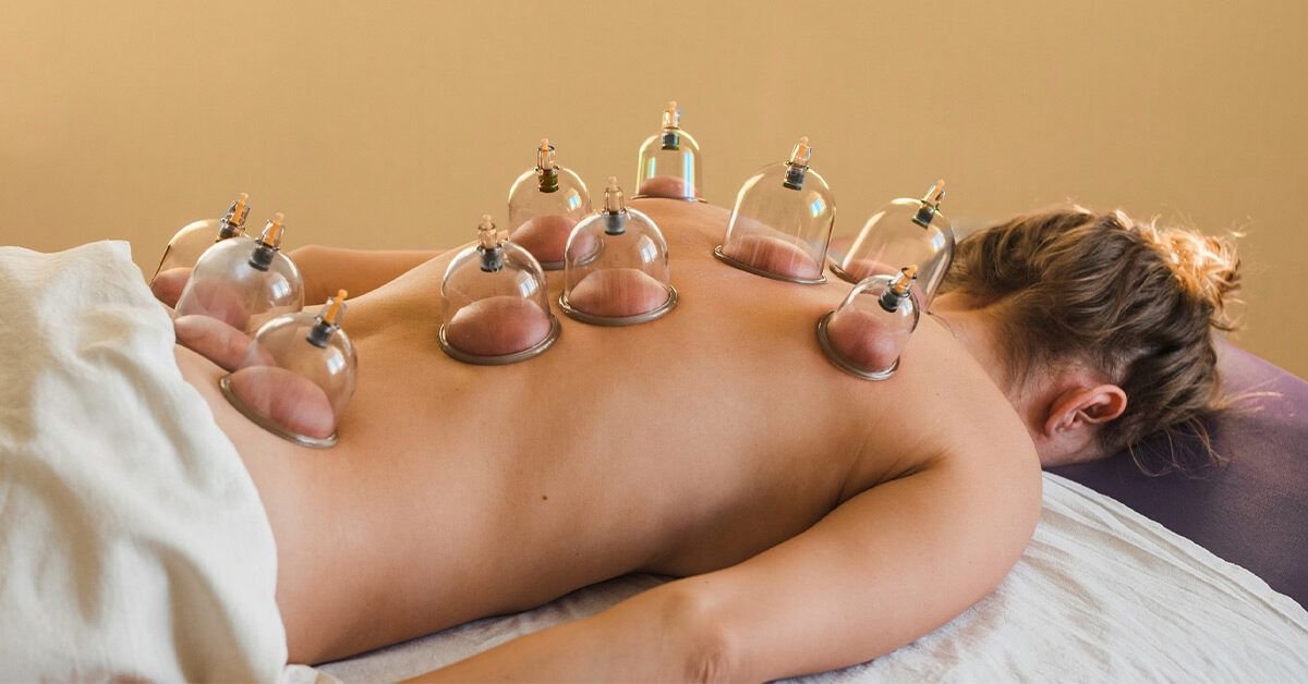Advanced Cupping Therapy at the clinic