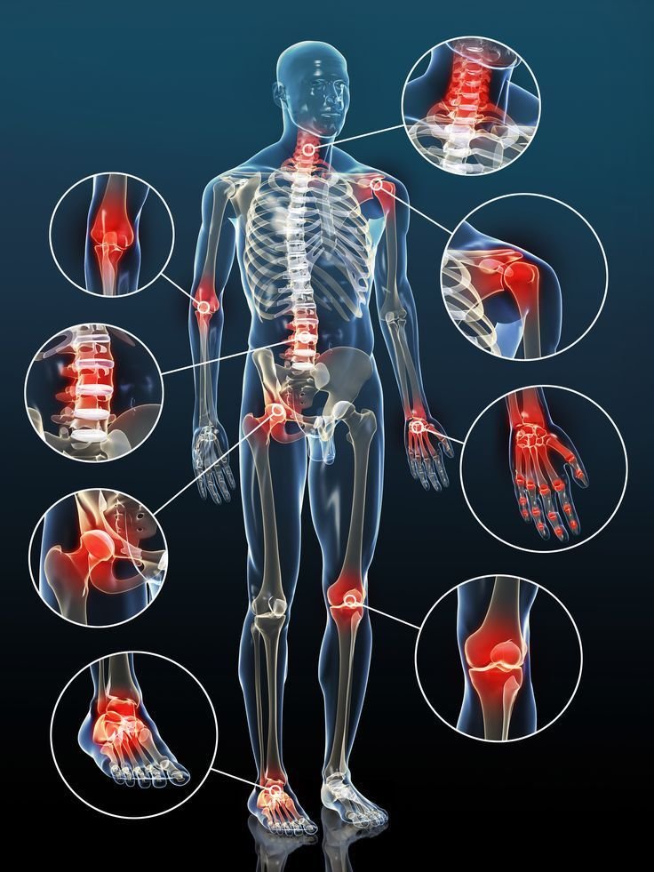 Physiotherapy treatment for physiotherapy for joints pain